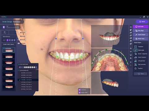 RAYFace Digital Smile Design — Ray America