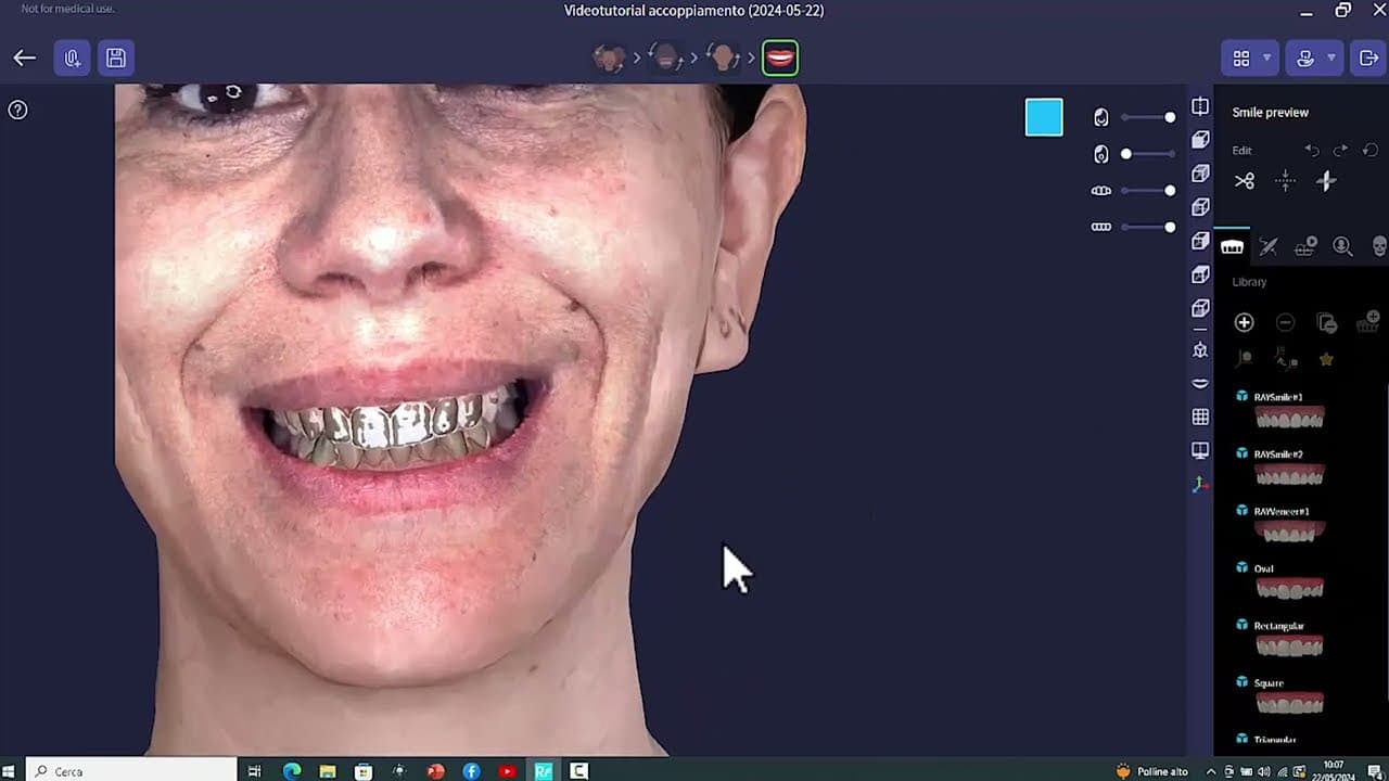 TRIOS 5 Wireless Intraoral Scanner — Digital Dental Impression