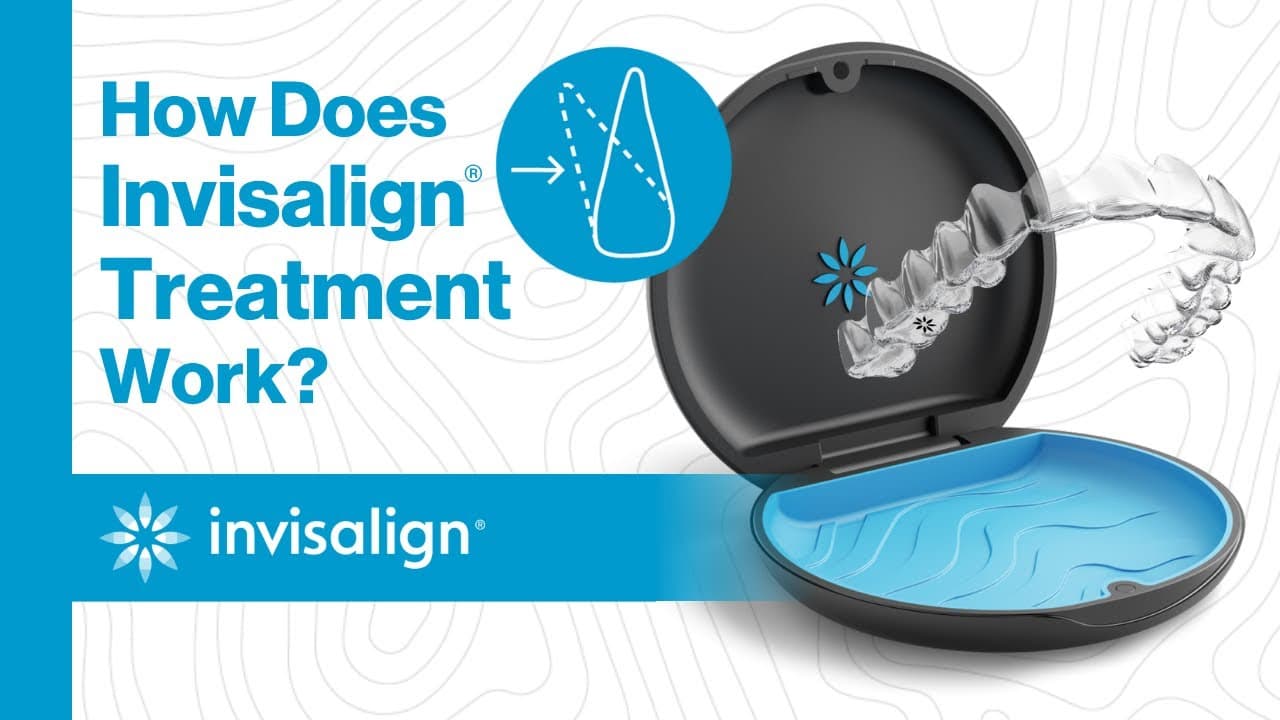 How Does Invisalign® Treatment Work?