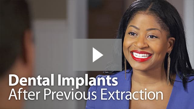 Implants After Extraction