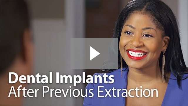 Implants After Extraction