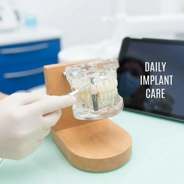 Gloved hand holding a transparent dental model displaying an implant structure on a wooden base in a clinical setting.