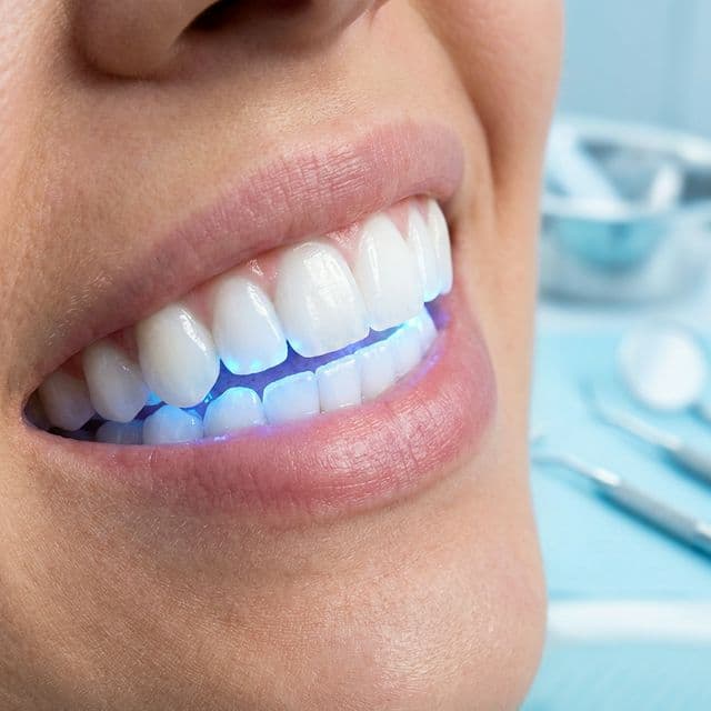 Brilliant white smile with Philips Zoom LED whitening light at Innova Smiles in Marlborough, MA